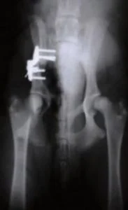 Hip Dysplasia Figure 4